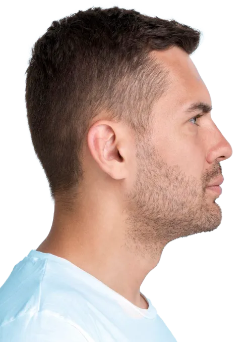 Armonización facial para hombres natural y elegante en manos de la Dra. Pamela Perez