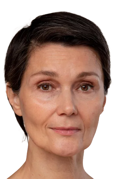 La doctora Pamela Perez renueva tu mirada y rostro con una blefaroplastia