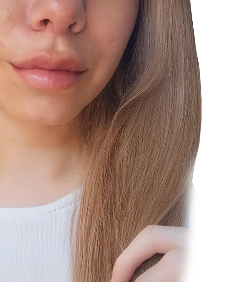 Los tratamientos no quirurgicos en el consultorio de la Dra. Pamela son ideales para prevenir signos de envejecimiento